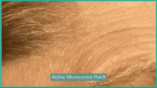 Load image into Gallery viewer, Contours Rx Microcrystal Patches (Set Of 4 Patches)