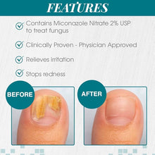 Load image into Gallery viewer, Nail Tek Anti Fungal Maximum Strength 10ml
